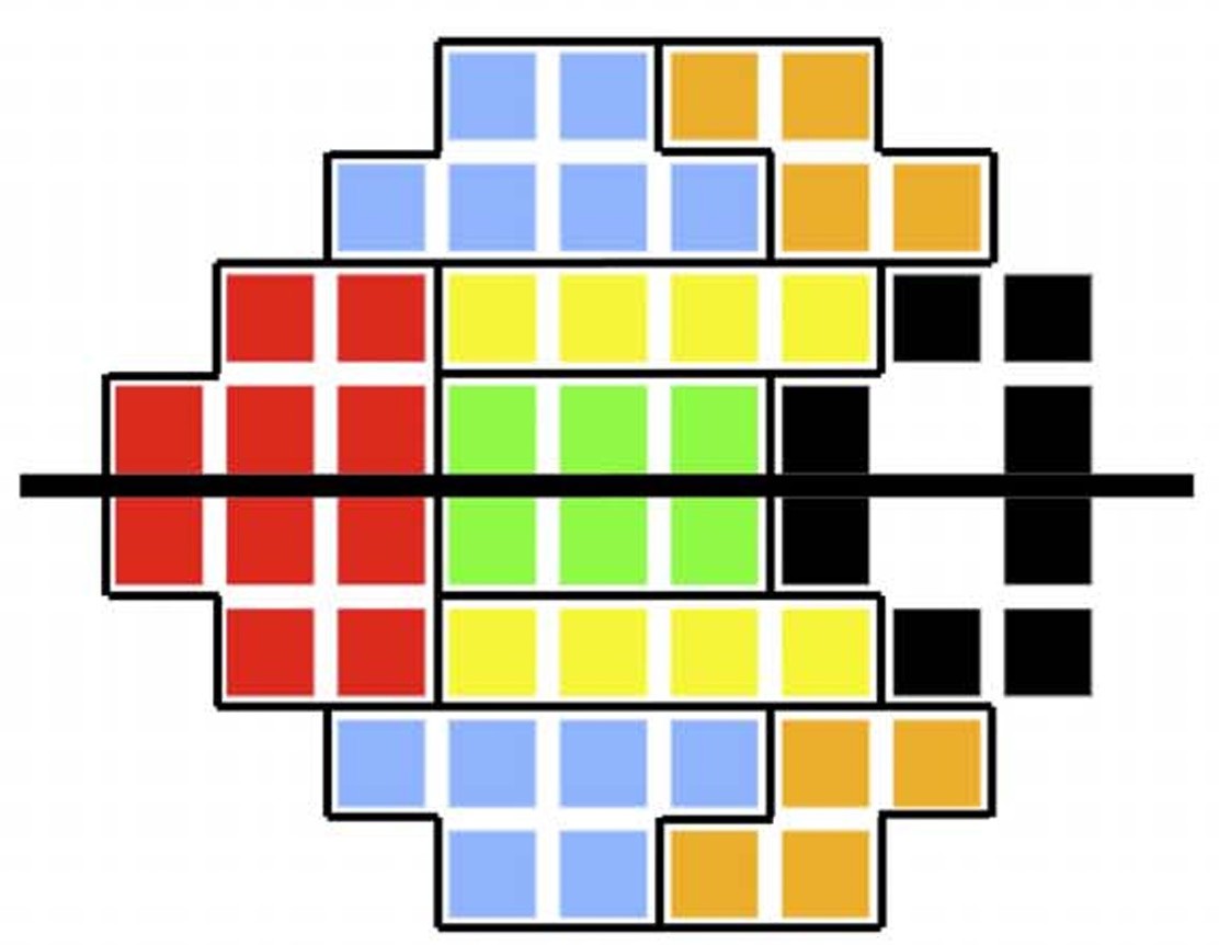 Visual Field Testing: A Guide to Interpreting Reports