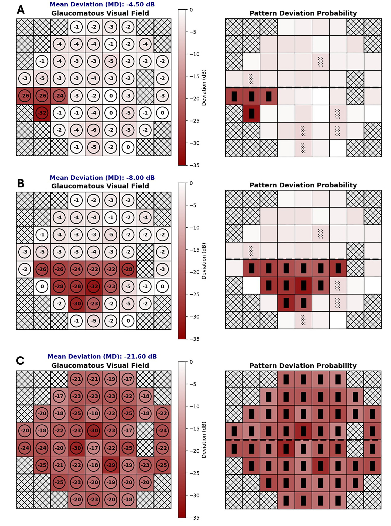 Visual Field Testing: A Guide to Interpreting Reports