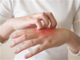 ‘Cumulative life course impairment’: The unforeseen burdens of severe eczema