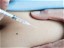 The evolving landscape of RA treatments