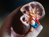 Johnson & Johnson’s Ethicon Undertakes First Robot-assisted Kidney Stone Removal